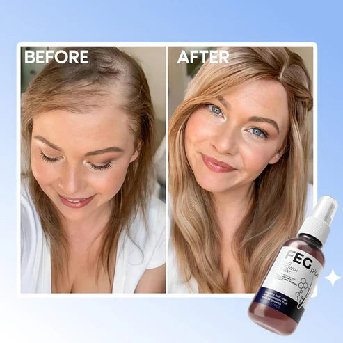 FEGPlus Minoxidil Beard & Hair Growth